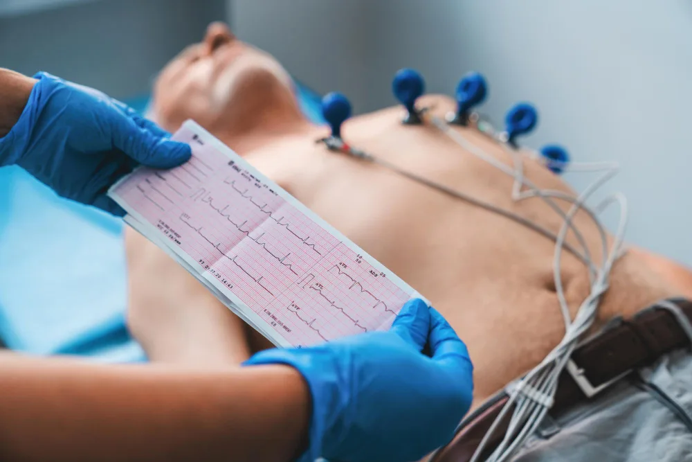 Electrocardiograma